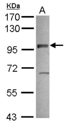 Western Blot: VEZT Antibody [NBP2-20855]