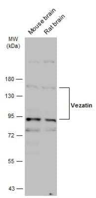 Western Blot: VEZT Antibody [NBP2-20855]