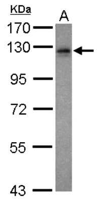 Western Blot: VEZT Antibody [NBP2-20856]