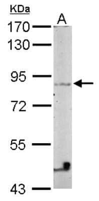 Western Blot: VEZT Antibody [NBP2-20856]