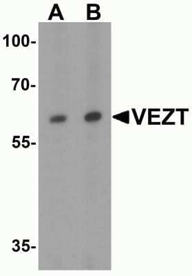 Western Blot: VEZT AntibodyBSA Free [NBP2-82044]