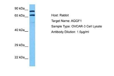 Western Blot: VG5Q Antibody [NBP2-82380]