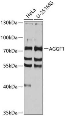 Western Blot: VG5Q AntibodyBSA Free [NBP3-03503]