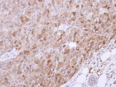 Immunohistochemistry-Paraffin: VIAAT/SLC32A1/VGAT Antibody [NBP2-20857]