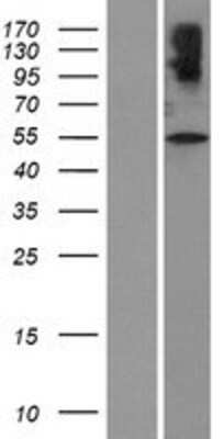 Western Blot: VIAAT/SLC32A1/VGAT Overexpression Lysate [NBP2-05774]