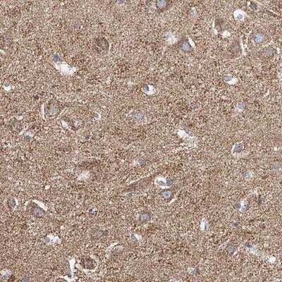 Immunohistochemistry-Paraffin: VGCNL1 Antibody [NBP1-90026]