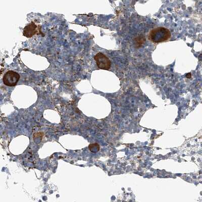 Immunohistochemistry-Paraffin: VGCNL1 Antibody [NBP1-90028]