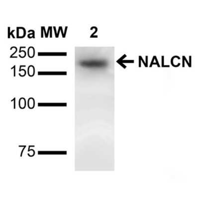 Western Blot: VGCNL1 Antibody (S187-7) [NBP2-22410]