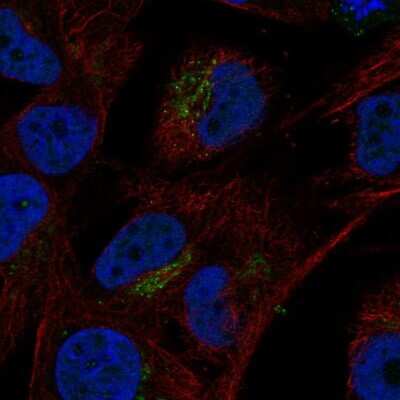 Immunocytochemistry/ Immunofluorescence: VGF Antibody [NBP2-31596]