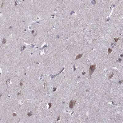 Immunohistochemistry-Paraffin: VGF Antibody [NBP2-31596]