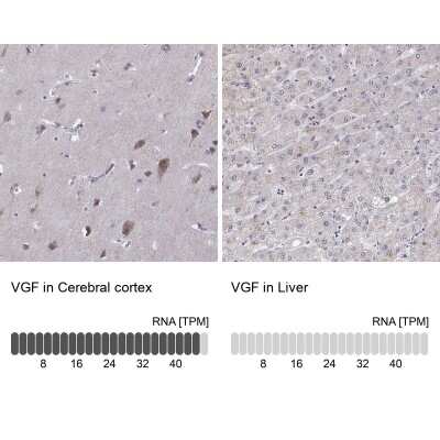Immunohistochemistry-Paraffin: VGF Antibody [NBP2-31596]