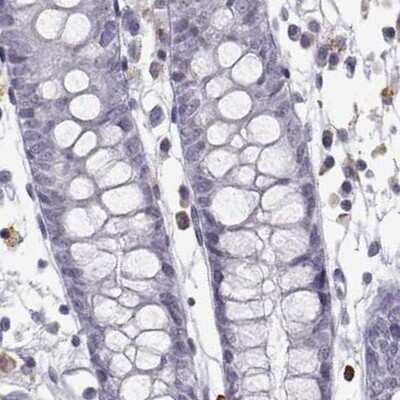 Immunohistochemistry-Paraffin: VGF Antibody [NBP2-31596]