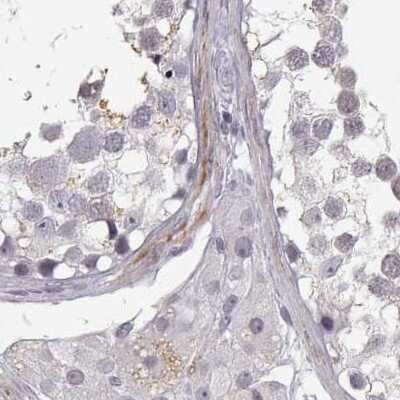 Immunohistochemistry-Paraffin: VGF Antibody [NBP2-31596]