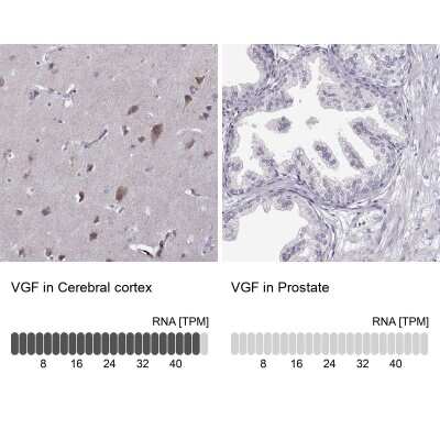 Immunohistochemistry-Paraffin: VGF Antibody [NBP2-31596]