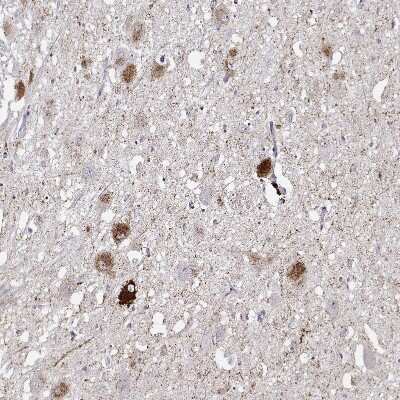 Immunohistochemistry-Paraffin: VGF Antibody [NBP2-31596]