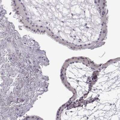 Immunohistochemistry-Paraffin: VGF Antibody [NBP2-31596]