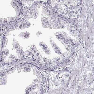 Immunohistochemistry-Paraffin: VGF Antibody [NBP2-31596]