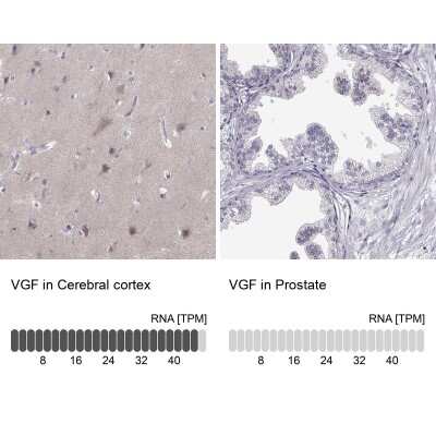 Immunohistochemistry-Paraffin: VGF Antibody [NBP2-56358]