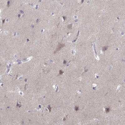 Immunohistochemistry-Paraffin: VGF Antibody [NBP2-56358]
