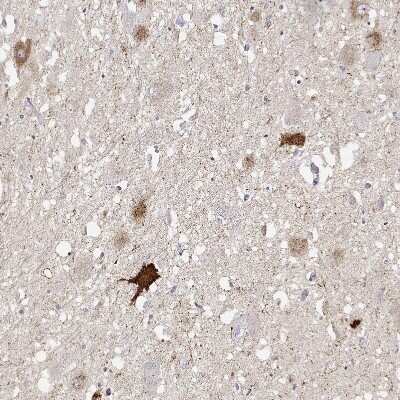 Immunohistochemistry-Paraffin: VGF Antibody [NBP2-56358]
