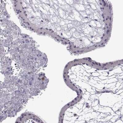 Immunohistochemistry-Paraffin: VGF Antibody [NBP2-56358]