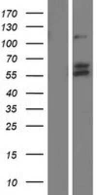 Western Blot: VGF Overexpression Lysate [NBP2-08018]