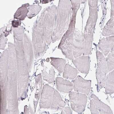 Immunohistochemistry-Paraffin: VGLL1 Antibody [NBP2-31921]