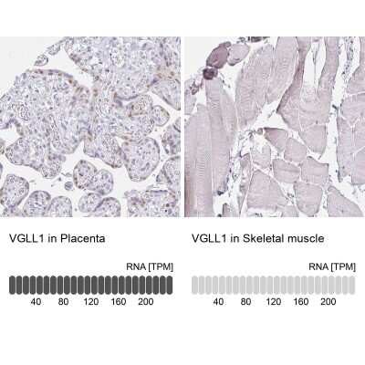 Immunohistochemistry-Paraffin: VGLL1 Antibody [NBP2-31921]