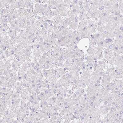 Immunohistochemistry-Paraffin: VGLL1 Antibody [NBP2-31921]