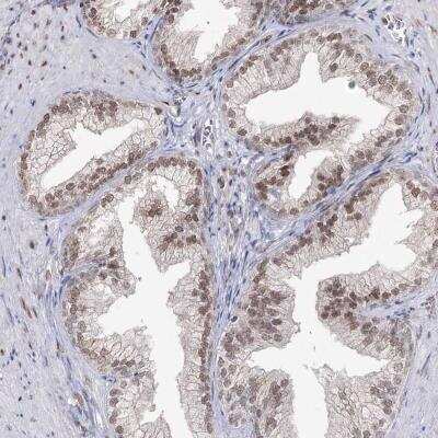 Immunohistochemistry-Paraffin: VGLL4 Antibody [NBP2-38421]