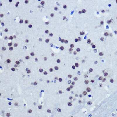 Immunohistochemistry-Paraffin: VGLL4 Antibody - Azide and BSA Free [NBP2-93539]