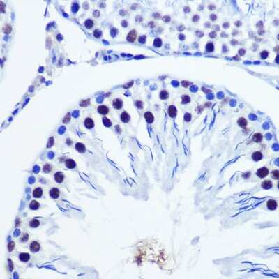 Immunohistochemistry-Paraffin: VGLL4 Antibody - Azide and BSA Free [NBP2-93539]