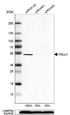 Western Blot: VGLL4 Antibody [NBP2-38421]