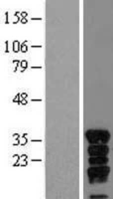 Western Blot: VGLL4 Overexpression Lysate [NBL1-17718]