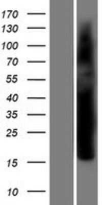 Western Blot: VGLL4 Overexpression Lysate [NBP2-09472]