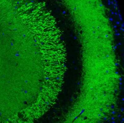 Immunohistochemistry: VGLUT1 Antibody (CL2754) [NBP2-46627]