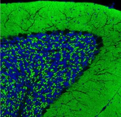 Immunohistochemistry: VGLUT1 Antibody (CL2754) [NBP2-46627]