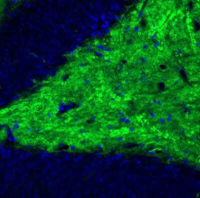 Immunohistochemistry: VGLUT1 Antibody (CL2754) [NBP2-46627]