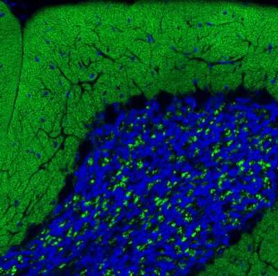 Immunohistochemistry: VGLUT1 Antibody (CL2754) [NBP2-46627]
