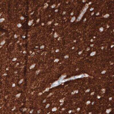 Immunohistochemistry-Paraffin: VGLUT1 Antibody (CL2754) [NBP2-46627]