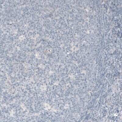 Immunohistochemistry-Paraffin: VGLUT1 Antibody (CL2754) [NBP2-46627]
