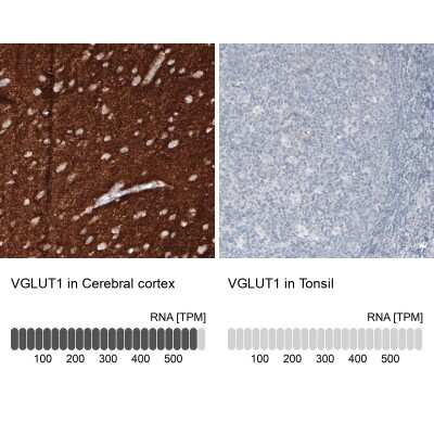 Immunohistochemistry-Paraffin: VGLUT1 Antibody (CL2754) [NBP2-46627]