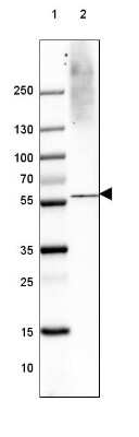Western Blot: VGLUT1 Antibody (CL2754) [NBP2-46627]