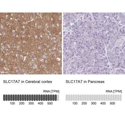 Immunohistochemistry-Paraffin: VGLUT1 Antibody [NBP2-33597]