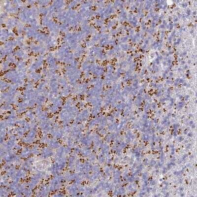 Immunohistochemistry-Paraffin: VGLUT1 Antibody [NBP2-33597]