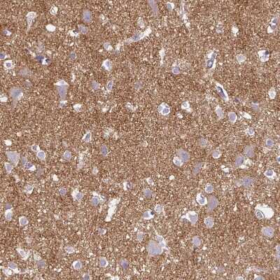 Immunohistochemistry-Paraffin: VGLUT1 Antibody [NBP2-33597]