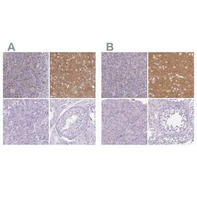 Immunohistochemistry-Paraffin: VGLUT1 Antibody [NBP2-33597]