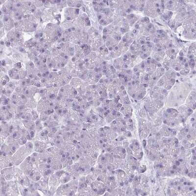 Immunohistochemistry-Paraffin: VGLUT1 Antibody [NBP2-33597]