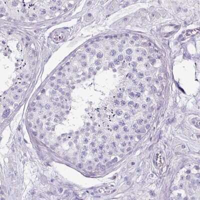 Immunohistochemistry-Paraffin: VGLUT1 Antibody [NBP2-33597]