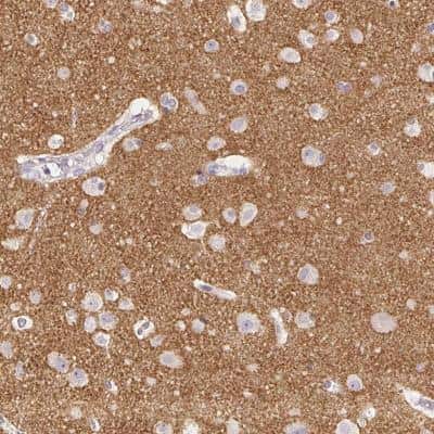 Immunohistochemistry-Paraffin: VGLUT1 Antibody [NBP2-39000]